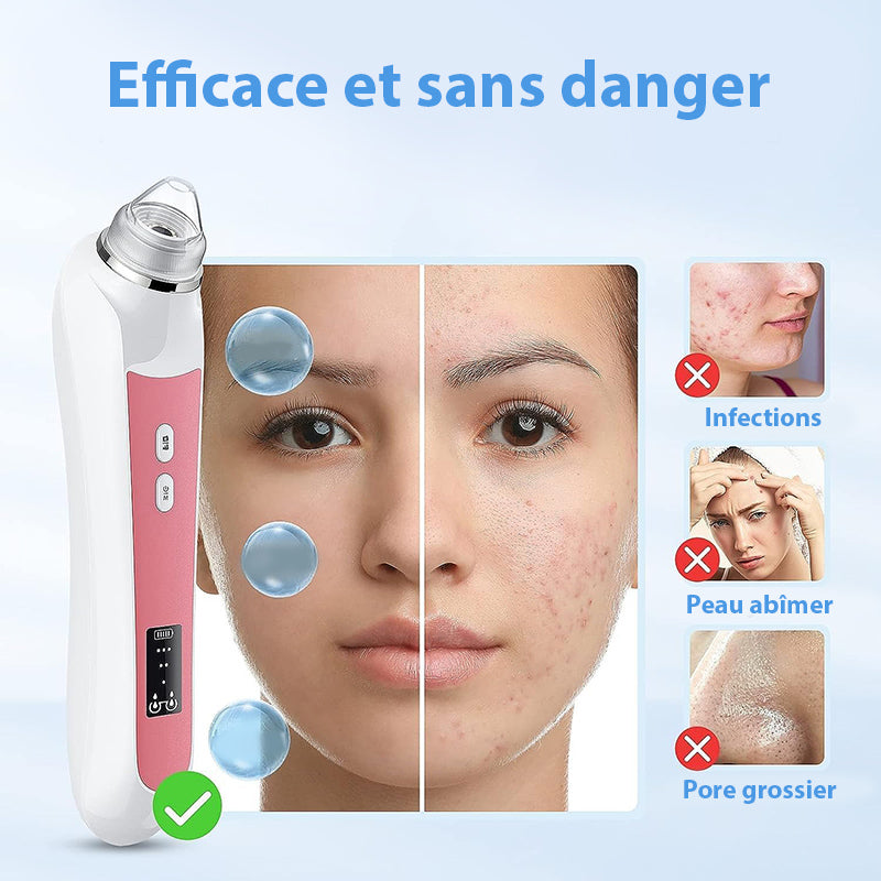 Aspirateur Point Noir avec Camera - Extracteur de Comédons & Nettoyeur de Pores Professionnel, technologie intelligente
